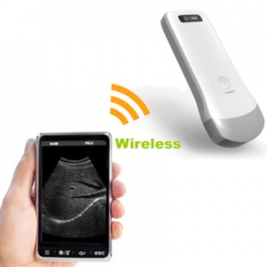 sonostar wireless ultrasound