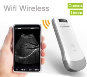 sonostar wireless ultrasound probe
