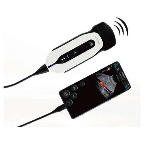 sonoeye vet ultrasound